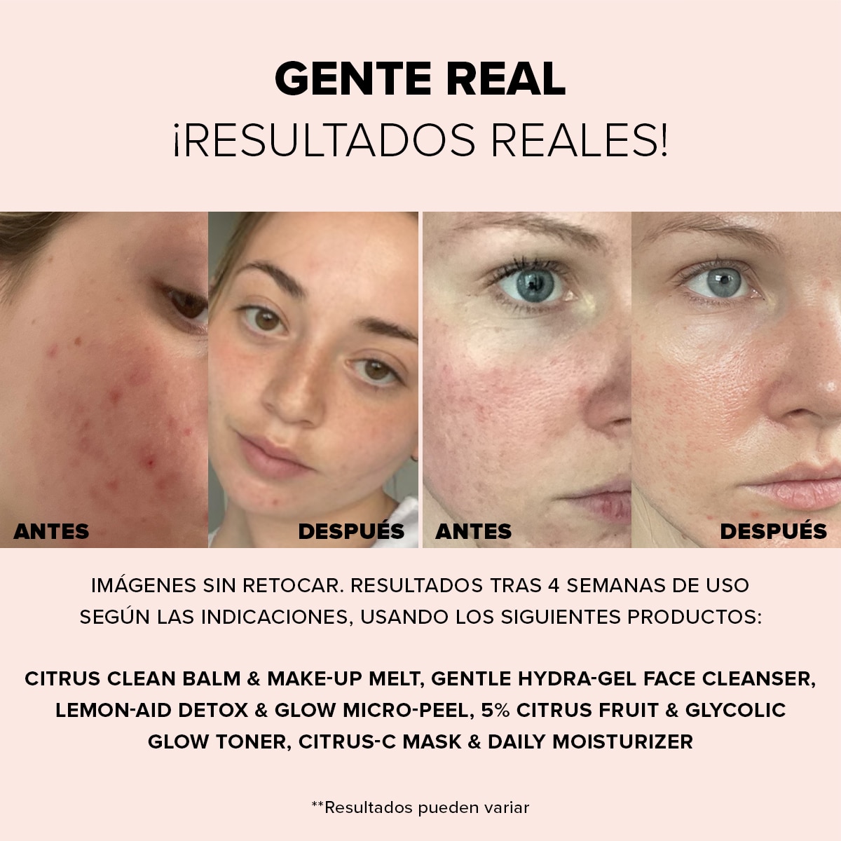 NUDESKIN LEMON-AID DETOX & GLOW MICRO-PEEL (EXFOLIANTE FACIAL)
